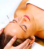 Cosmetic Acupuncture in Chicago Area