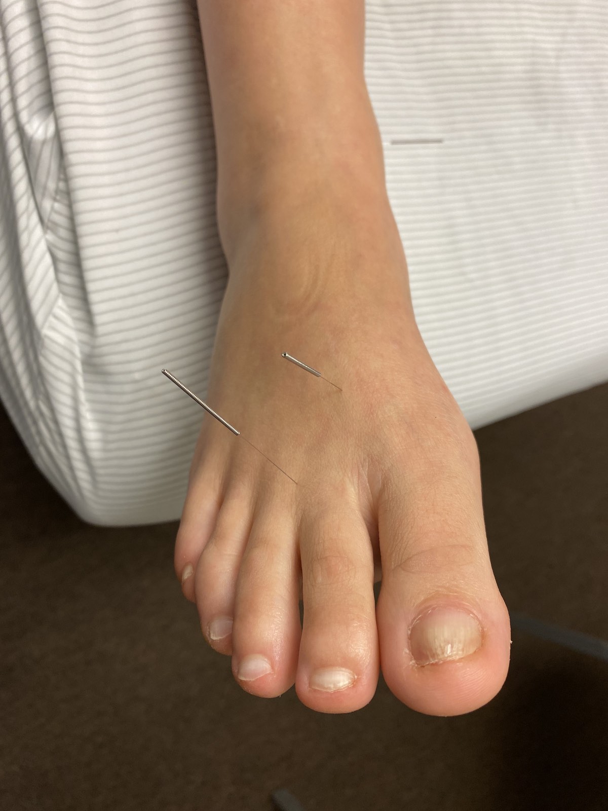 Acupuncture foot two
