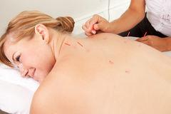 Acupuncture therapy in Park Ridge Chicago