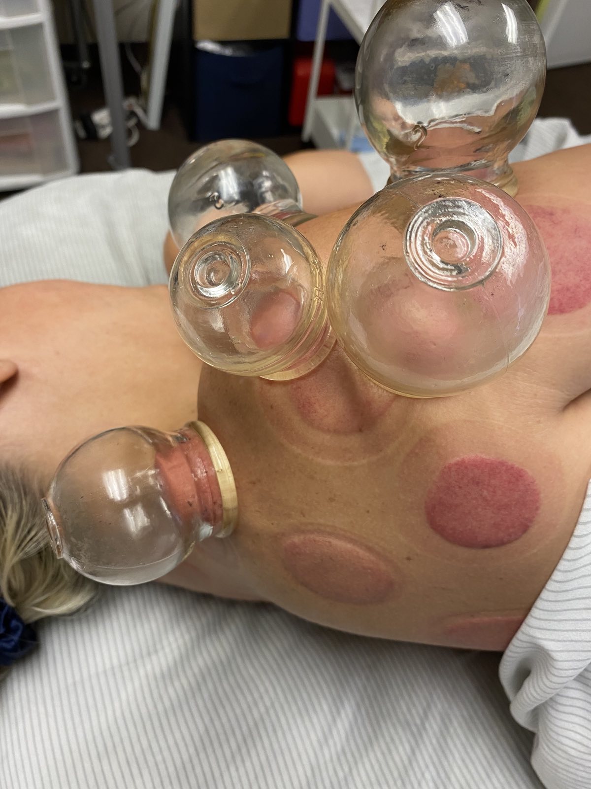 Cupping legs shoulder two