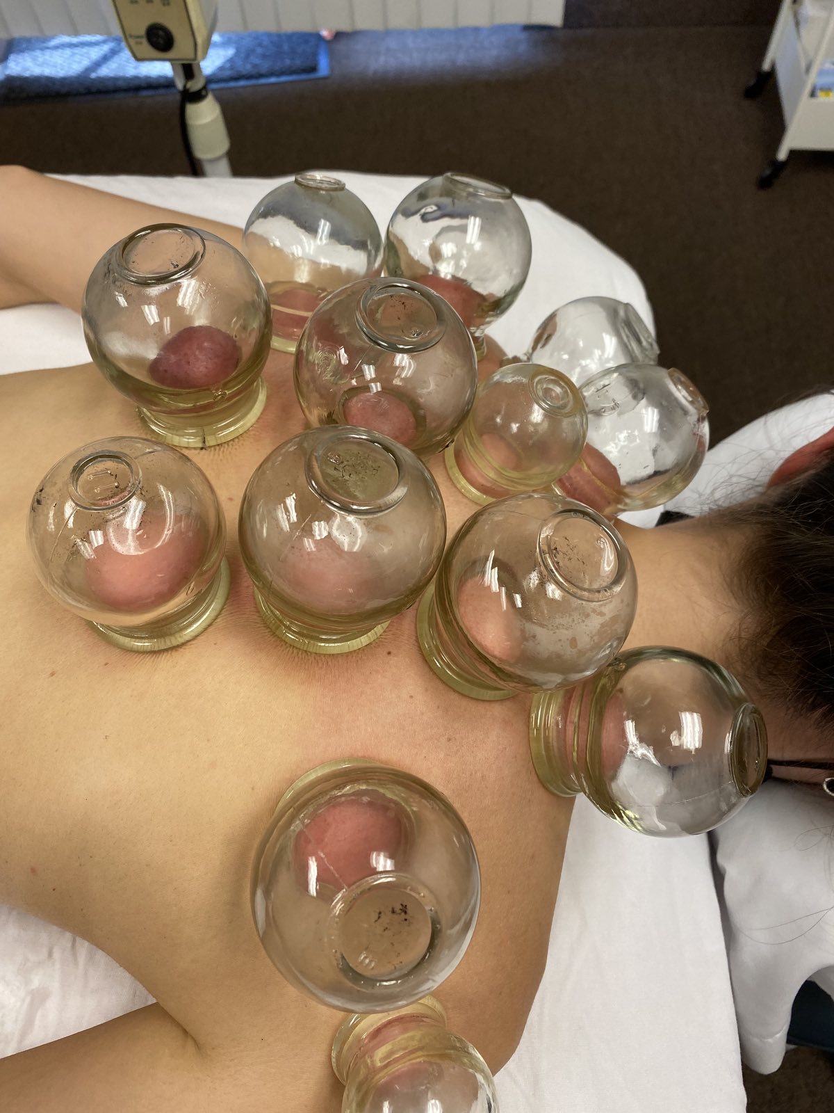 Cupping two